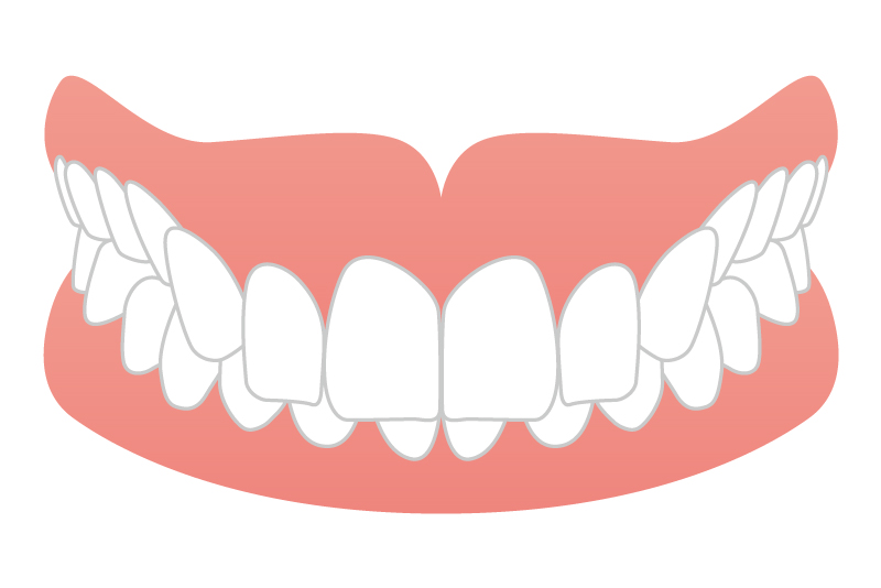 下の歯が見えない