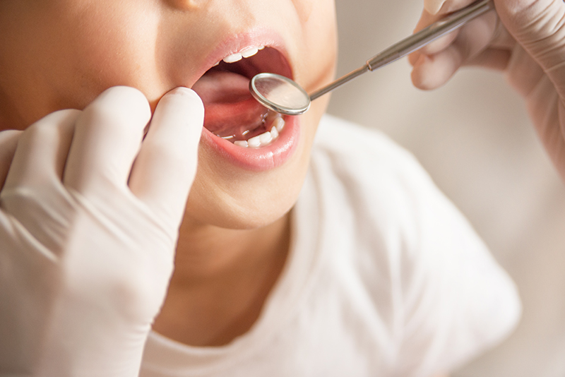 理想的な歯並び