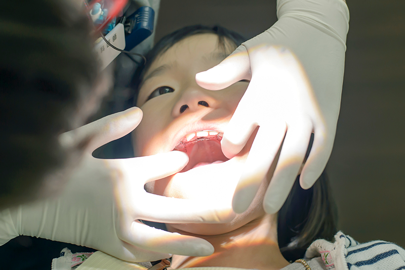 精密検査（60分）