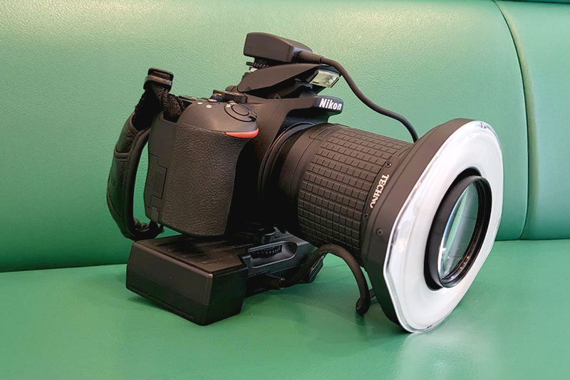 口腔内カメラ（一眼レフ）