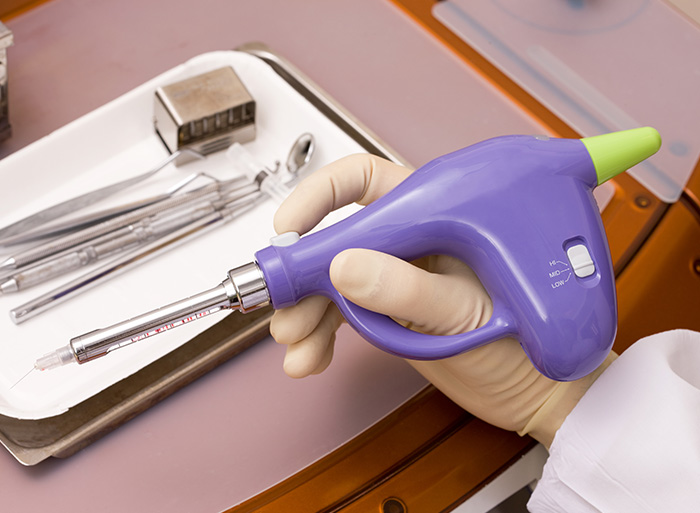 痛みに配慮し、麻酔にもこだわりを