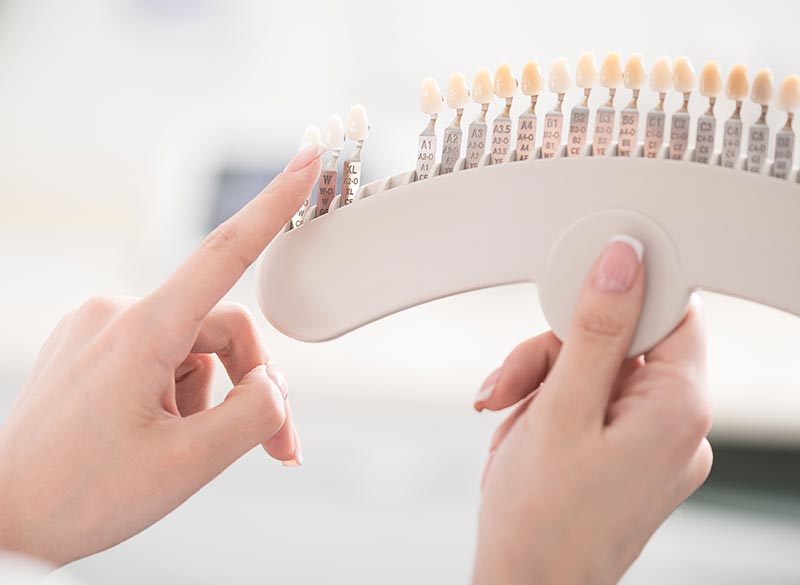 ホワイトニング